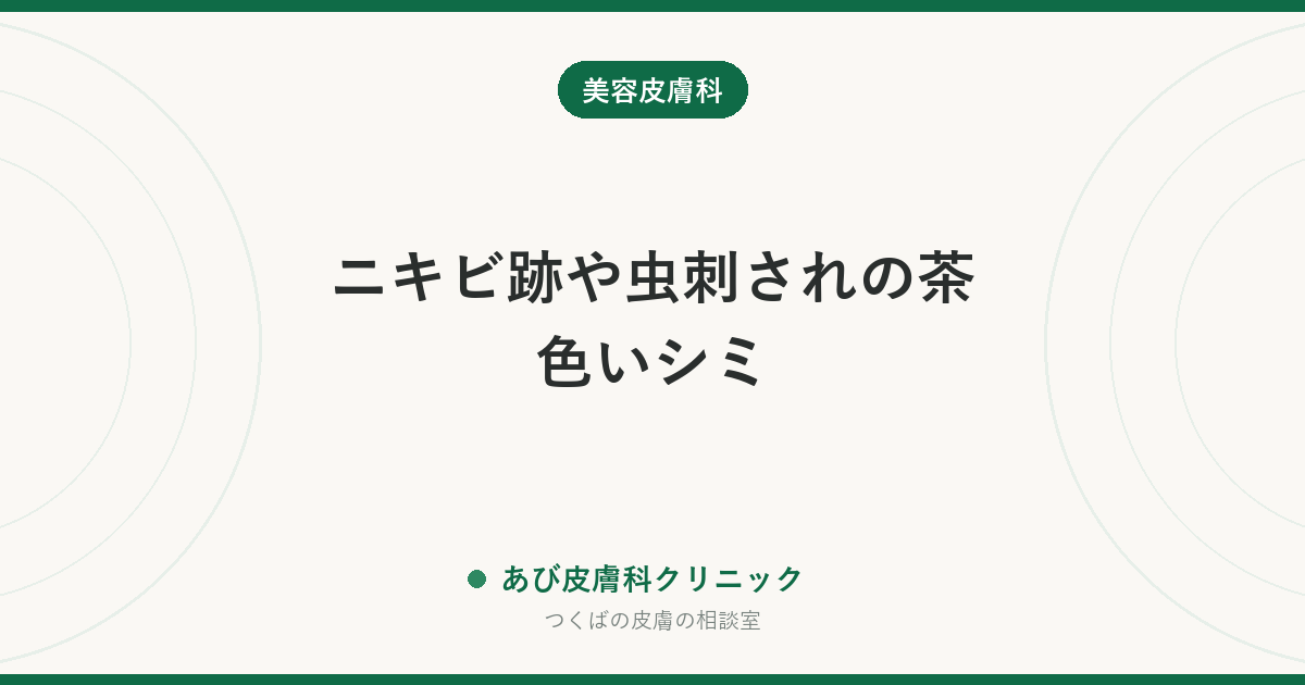 ニキビ跡や虫刺されの茶色いシミ｜炎症後色素沈着が消えるまでの期間と薄くする方法