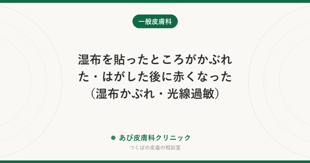 湿布を貼ったところがかぶれた・はがした後に赤くなった（湿布かぶれ・光線過敏）｜原因の見分けと治し方、貼るときの工夫