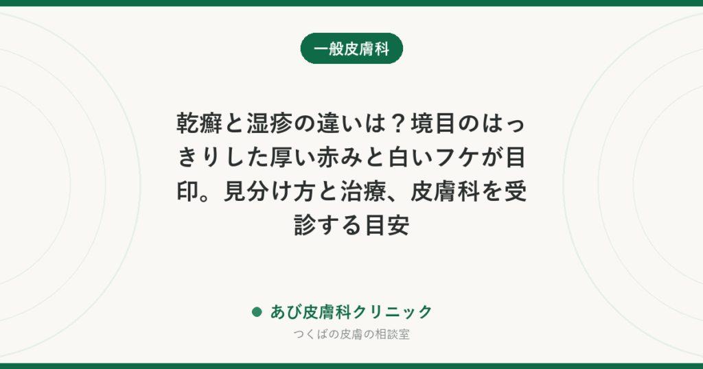 乾癬と湿疹の違いは？境目のはっきりした厚い赤みと白いフケが目印。見分け方と治療、皮膚科を受診する目安