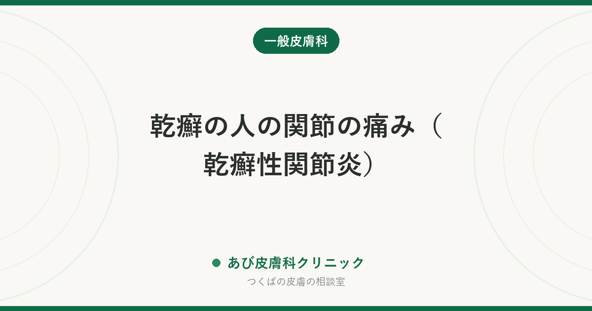 乾癬の人の関節の痛み（乾癬性関節炎）｜朝のこわばり・指の腫れ・かかとの痛みを見逃さない