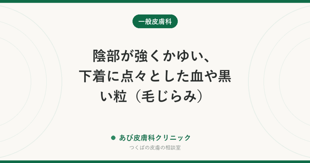 陰部が強くかゆい、下着に点々とした血や黒い粒（毛じらみ）｜市販薬での治し方と、パートナーと一緒に治す理由