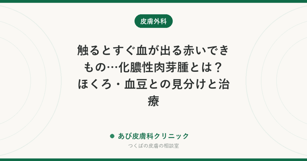 触るとすぐ血が出る赤いできもの…化膿性肉芽腫とは？ほくろ・血豆との見分けと治療