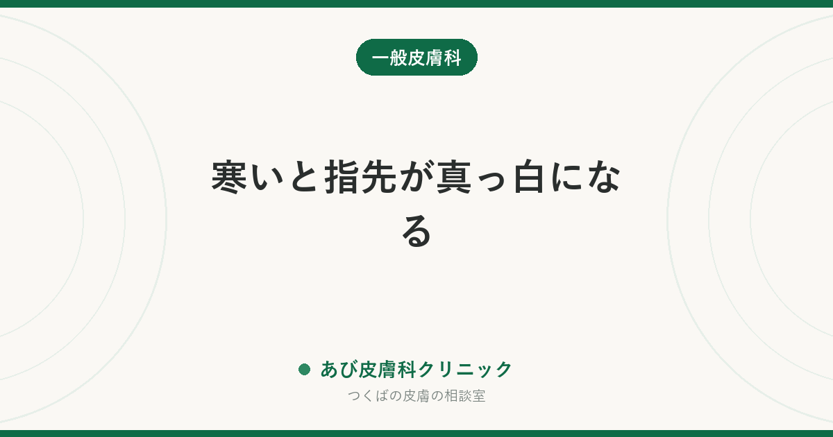 寒いと指先が真っ白になる｜レイノー現象の見分けと、しもやけとの決定的な違い