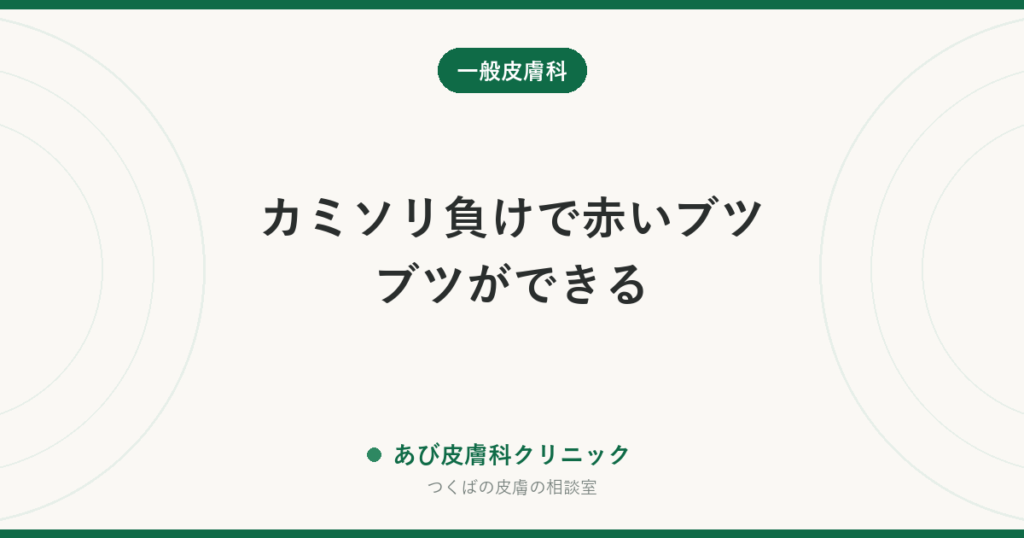 カミソリ負けで赤いブツブツができる｜髭剃り後の炎症の原因・治し方と繰り返さない剃り方