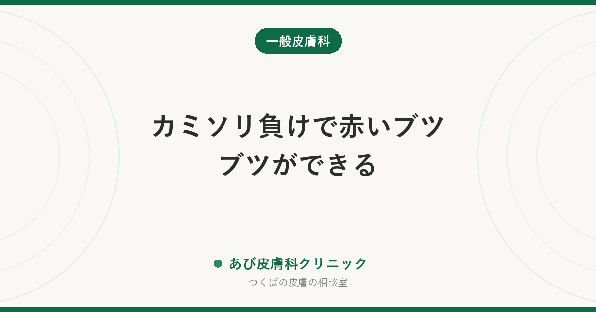 カミソリ負けで赤いブツブツができる｜髭剃り後の炎症の原因・治し方と繰り返さない剃り方