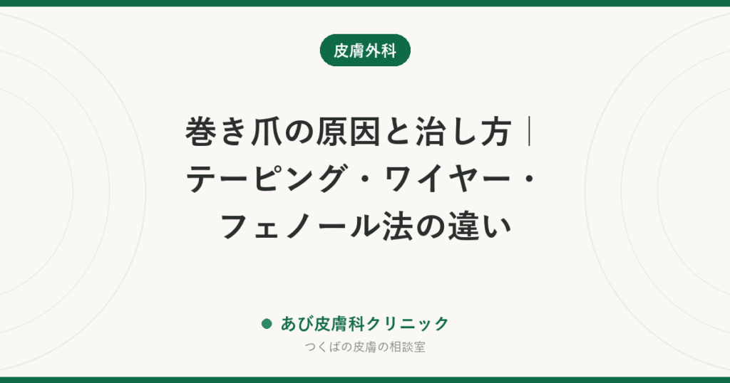 巻き爪の原因と治し方｜テーピング・ワイヤー・フェノール法の違い