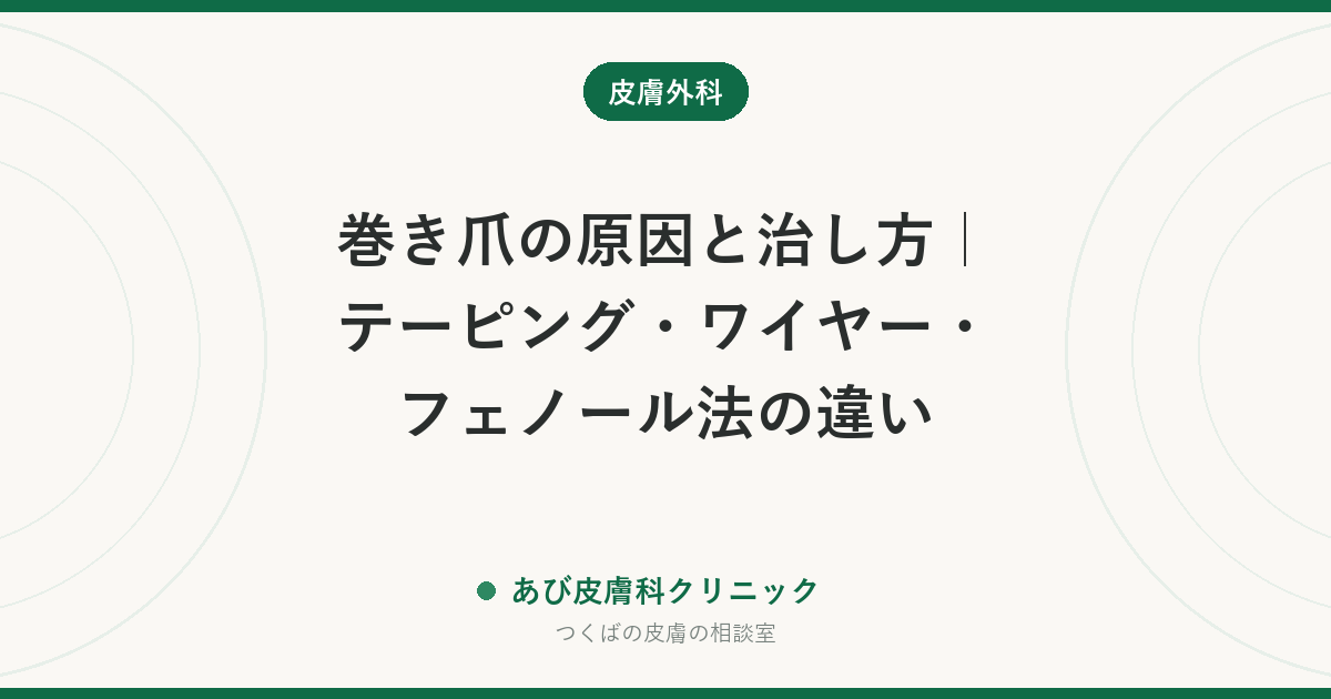 巻き爪の原因と治し方｜テーピング・ワイヤー・フェノール法の違い