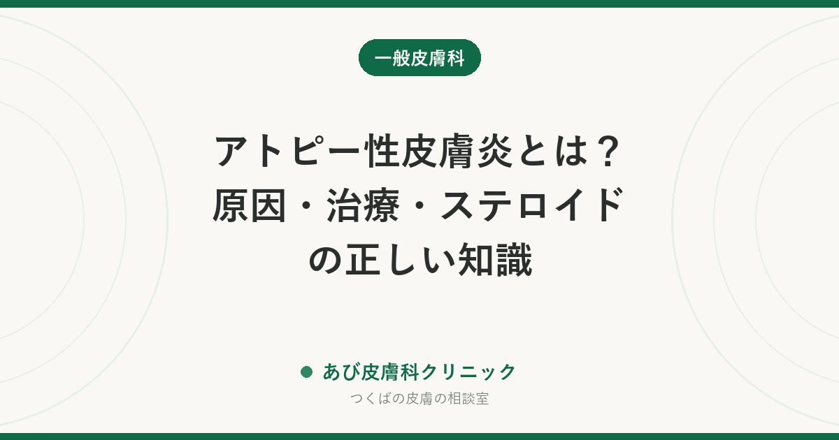 アトピー性皮膚炎とは？原因・治療・ステロイドの正しい知識