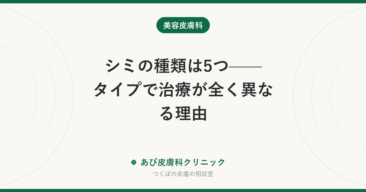 シミの種類は5つ——タイプで治療が全く異なる理由