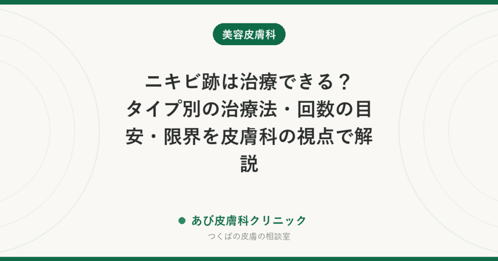 ニキビ跡は治療できる？タイプ別の治療法・回数の目安・限界を皮膚科の視点で解説