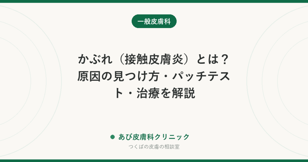 かぶれ（接触皮膚炎）とは？原因の見つけ方・パッチテスト・治療を解説