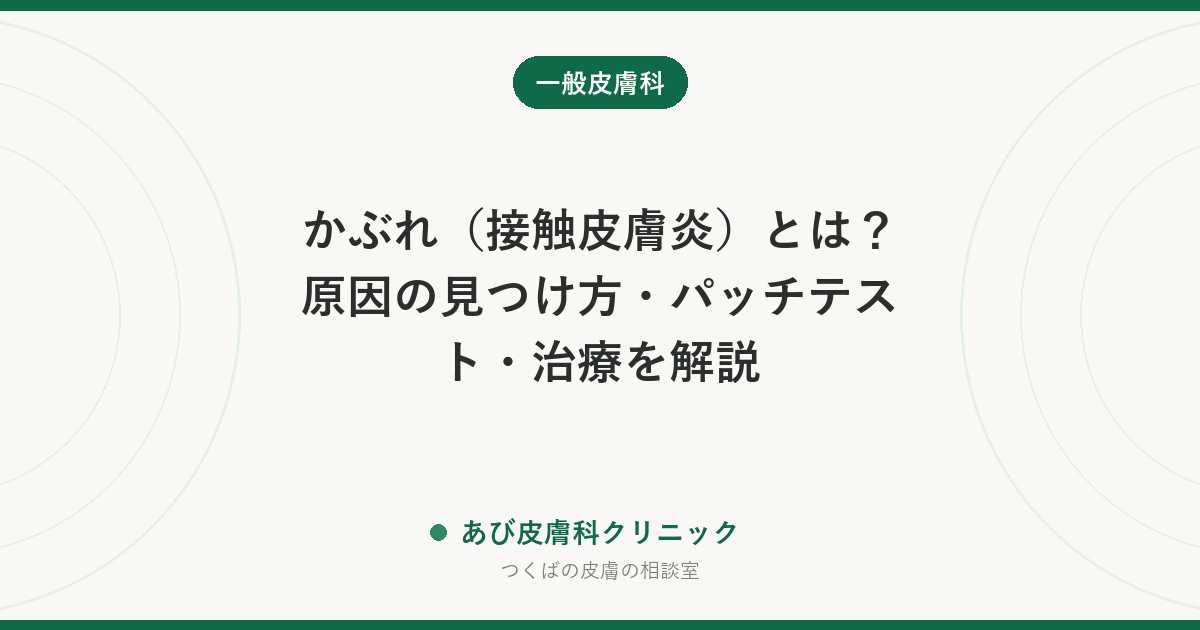かぶれ（接触皮膚炎）とは？原因の見つけ方・パッチテスト・治療を解説
