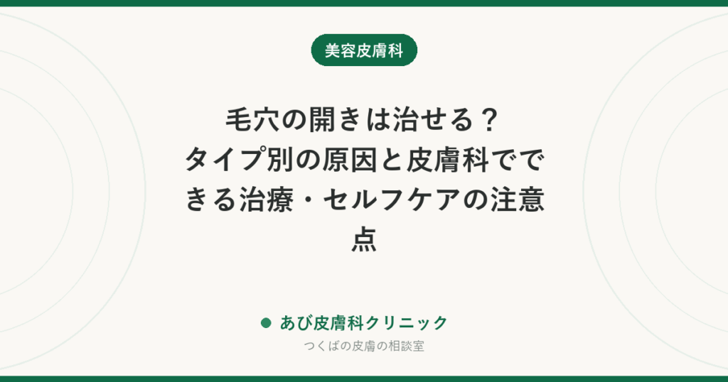 毛穴の開きは治せる？タイプ別の原因と皮膚科でできる治療・セルフケアの注意点