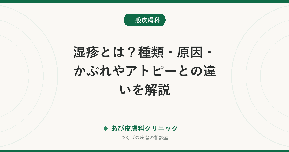 湿疹とは？種類・原因・かぶれやアトピーとの違いを解説