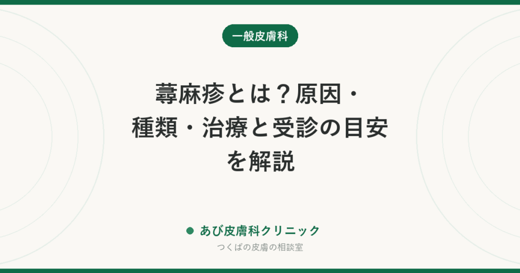 蕁麻疹とは？原因・種類・治療と受診の目安を解説