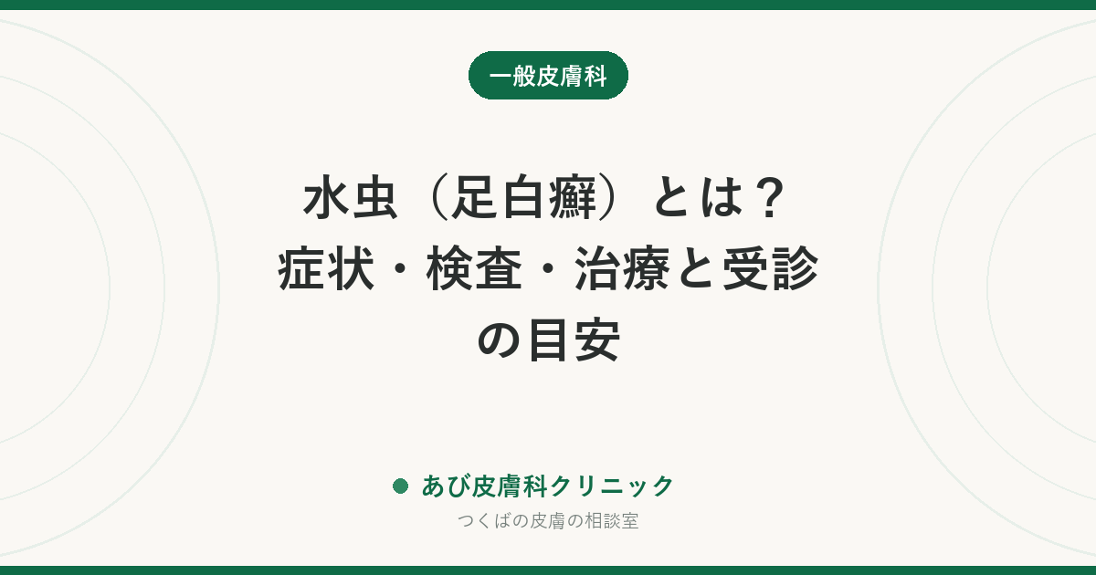 水虫（足白癬）とは？症状・検査・治療と受診の目安