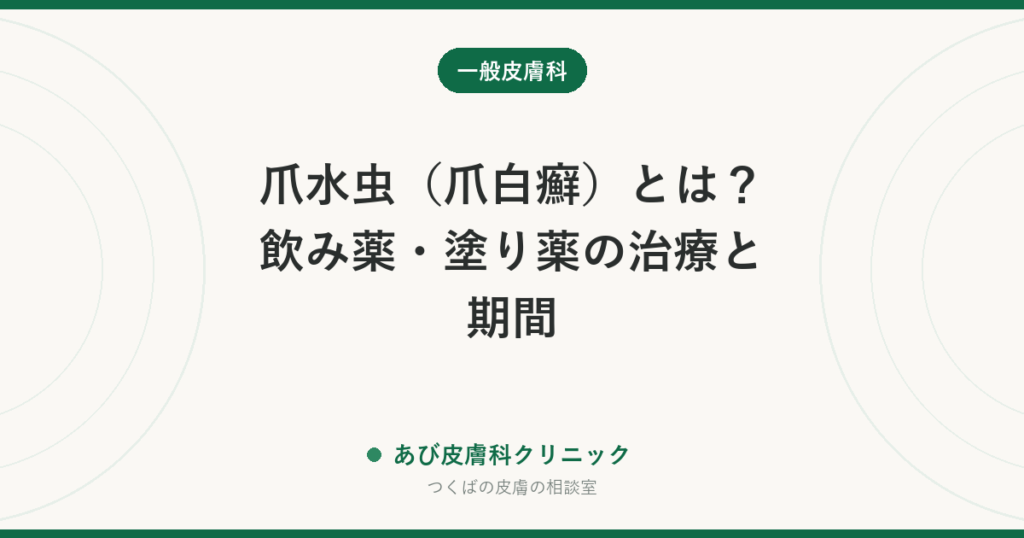 爪水虫（爪白癬）とは？飲み薬・塗り薬の治療と期間