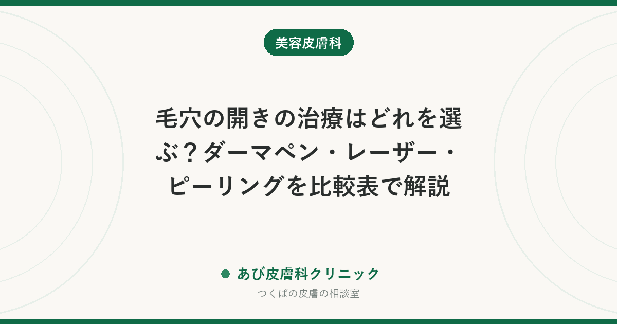 毛穴の開きの治療はどれを選ぶ？ダーマペン・レーザー・ピーリングを比較表で解説