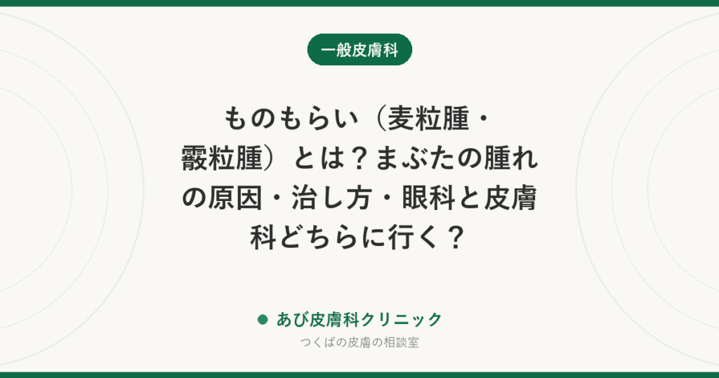 ものもらい（麦粒腫・霰粒腫）とは？まぶたの腫れの原因・治し方・眼科と皮膚科どちらに行く？