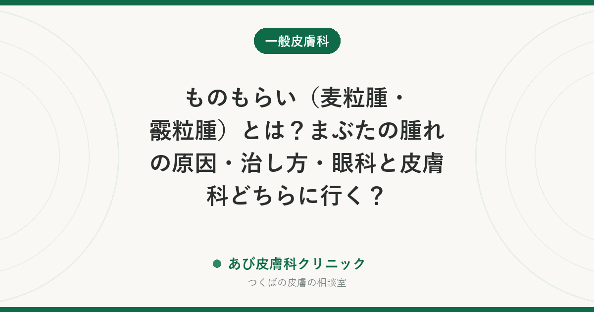 ものもらい（麦粒腫・霰粒腫）とは？まぶたの腫れの原因・治し方・眼科と皮膚科どちらに行く？