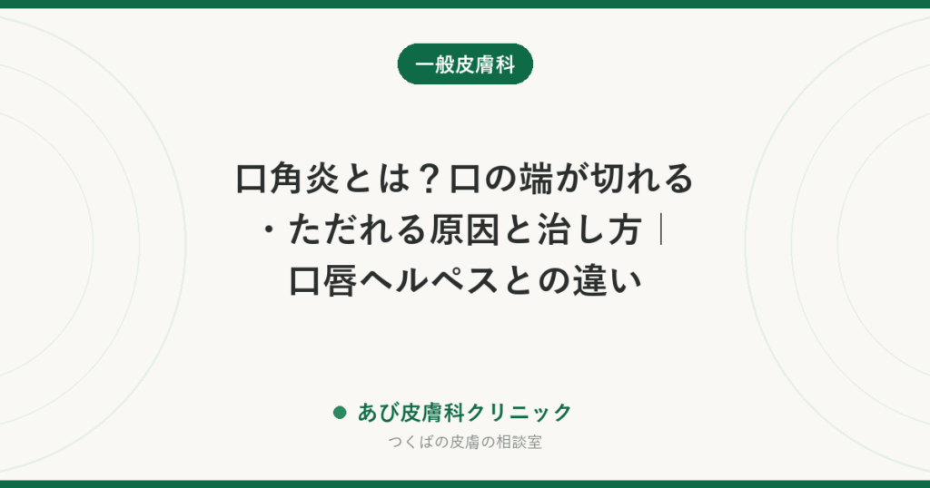 口角炎とは？口の端が切れる・ただれる原因と治し方｜口唇ヘルペスとの違い