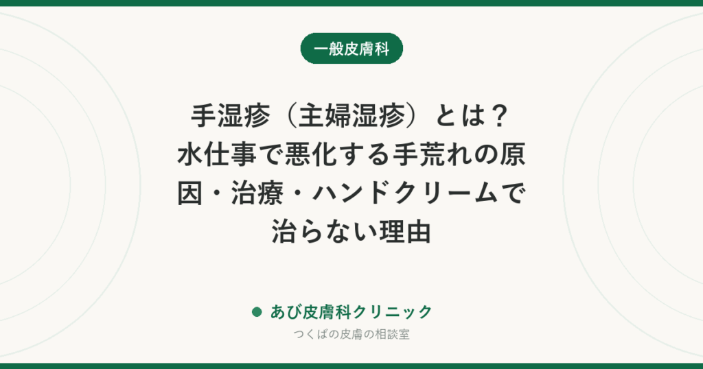 手湿疹（主婦湿疹）とは？水仕事で悪化する手荒れの原因・治療・ハンドクリームで治らない理由