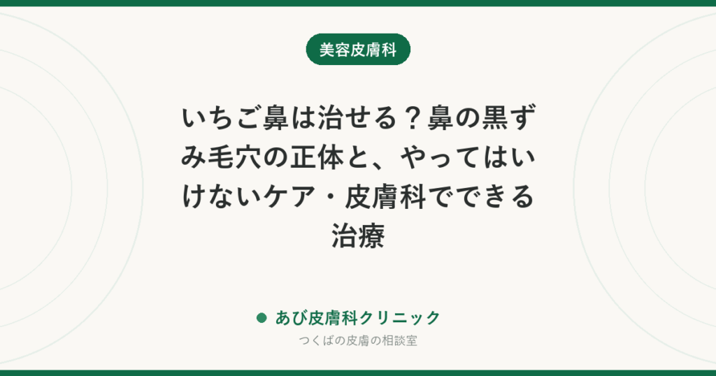 いちご鼻は治せる？鼻の黒ずみ毛穴の正体と、やってはいけないケア・皮膚科でできる治療