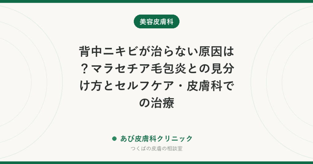 背中ニキビが治らない原因は？マラセチア毛包炎との見分け方とセルフケア・皮膚科での治療