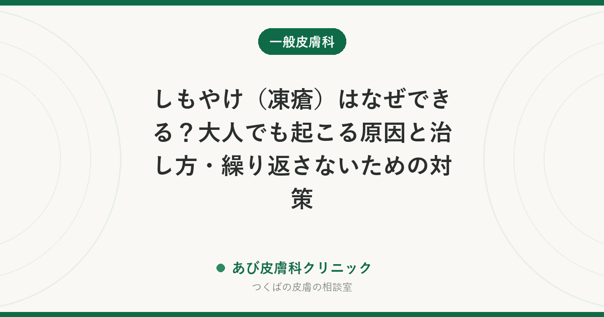 しもやけ（凍瘡）はなぜできる？大人でも起こる原因と治し方・繰り返さないための対策