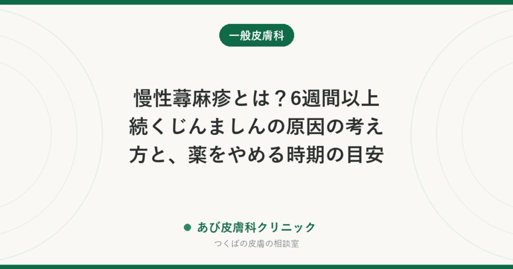 慢性蕁麻疹とは？6週間以上続くじんましんの原因の考え方と、薬をやめる時期の目安