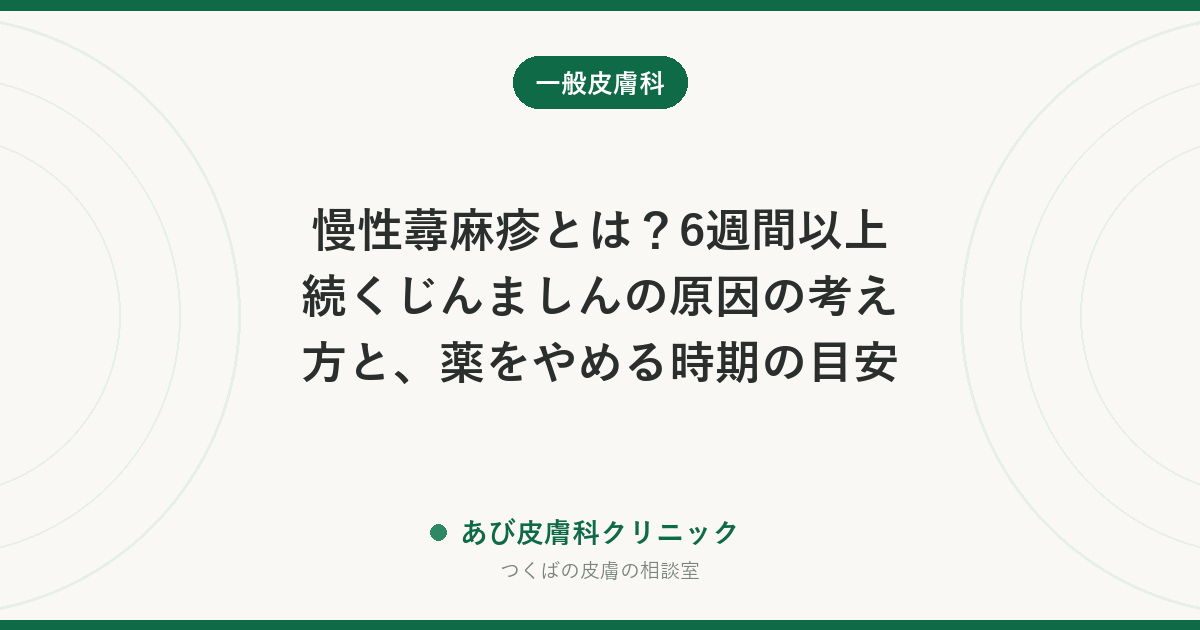 慢性蕁麻疹とは？6週間以上続くじんましんの原因の考え方と、薬をやめる時期の目安