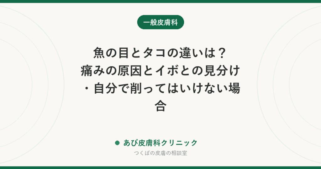 魚の目とタコの違いは？痛みの原因とイボとの見分け・自分で削ってはいけない場合