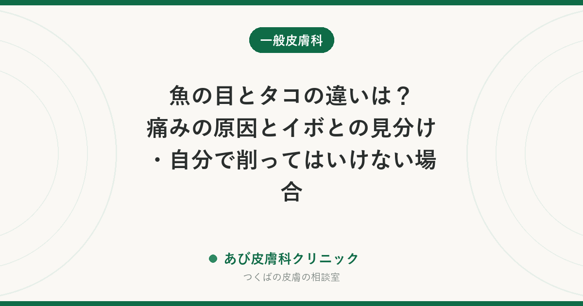 魚の目とタコの違いは？痛みの原因とイボとの見分け・自分で削ってはいけない場合