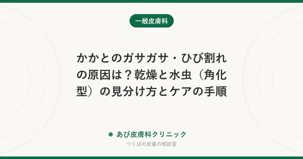 かかとのガサガサ・ひび割れの原因は？乾燥と水虫（角化型）の見分け方とケアの手順