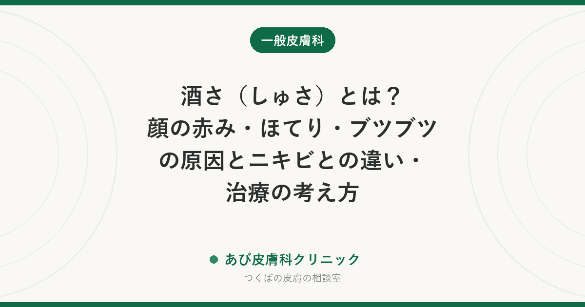 酒さ（しゅさ）とは？顔の赤み・ほてり・ブツブツの原因とニキビとの違い・治療の考え方