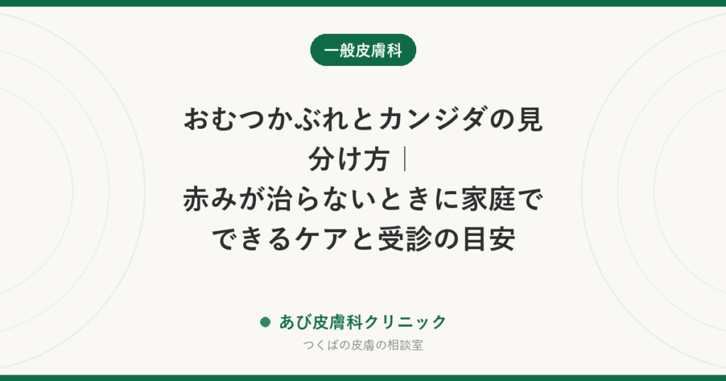 おむつかぶれとカンジダの見分け方｜赤みが治らないときに家庭でできるケアと受診の目安