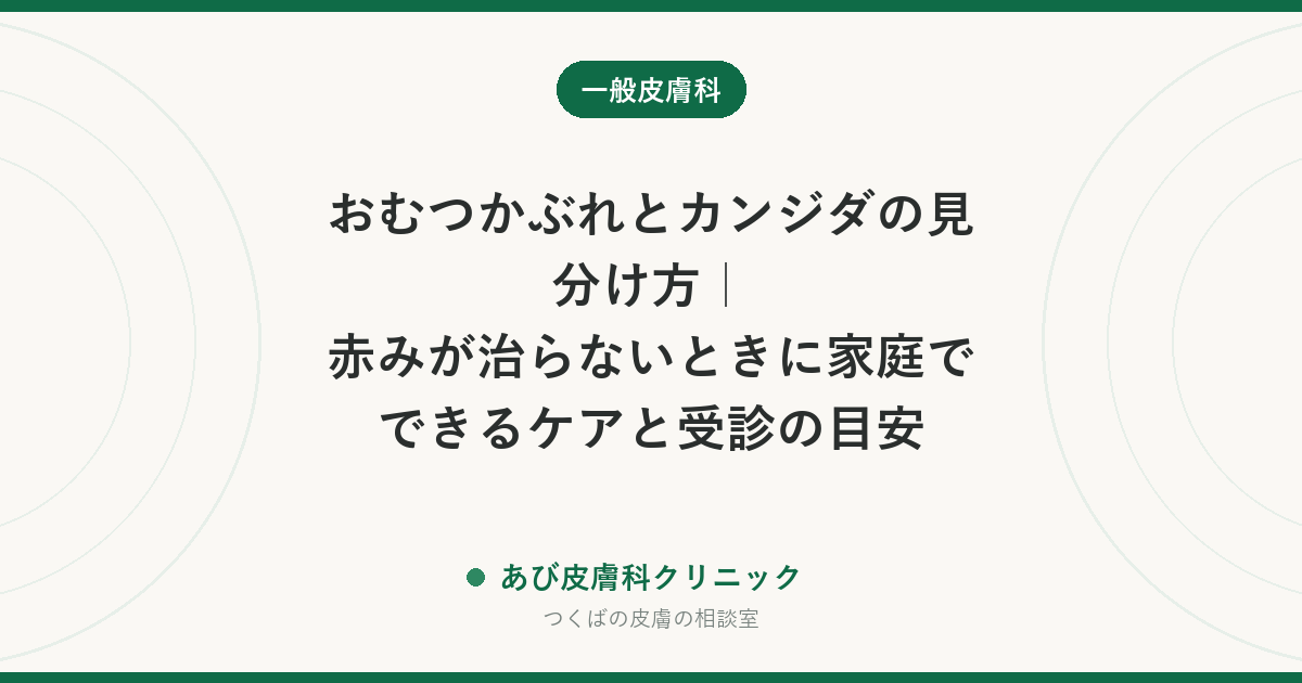 おむつかぶれとカンジダの見分け方｜赤みが治らないときに家庭でできるケアと受診の目安