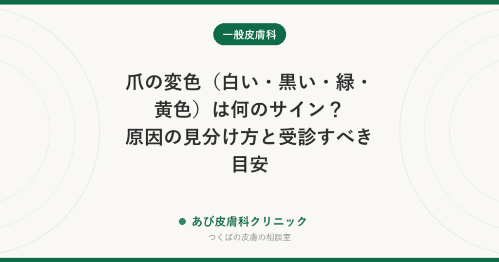 爪の変色（白い・黒い・緑・黄色）は何のサイン？原因の見分け方と受診すべき目安