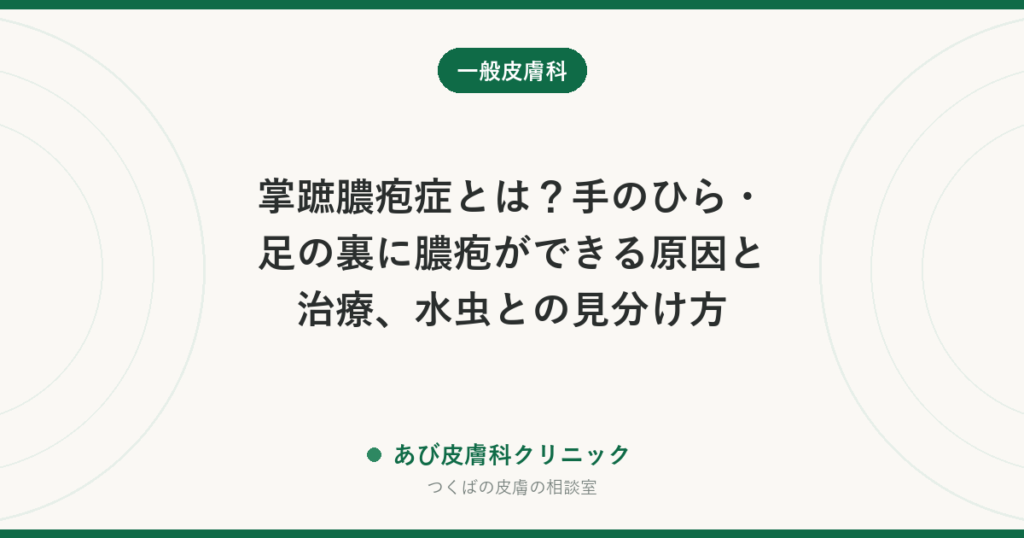 掌蹠膿疱症とは？手のひら・足の裏に膿疱ができる原因と治療、水虫との見分け方