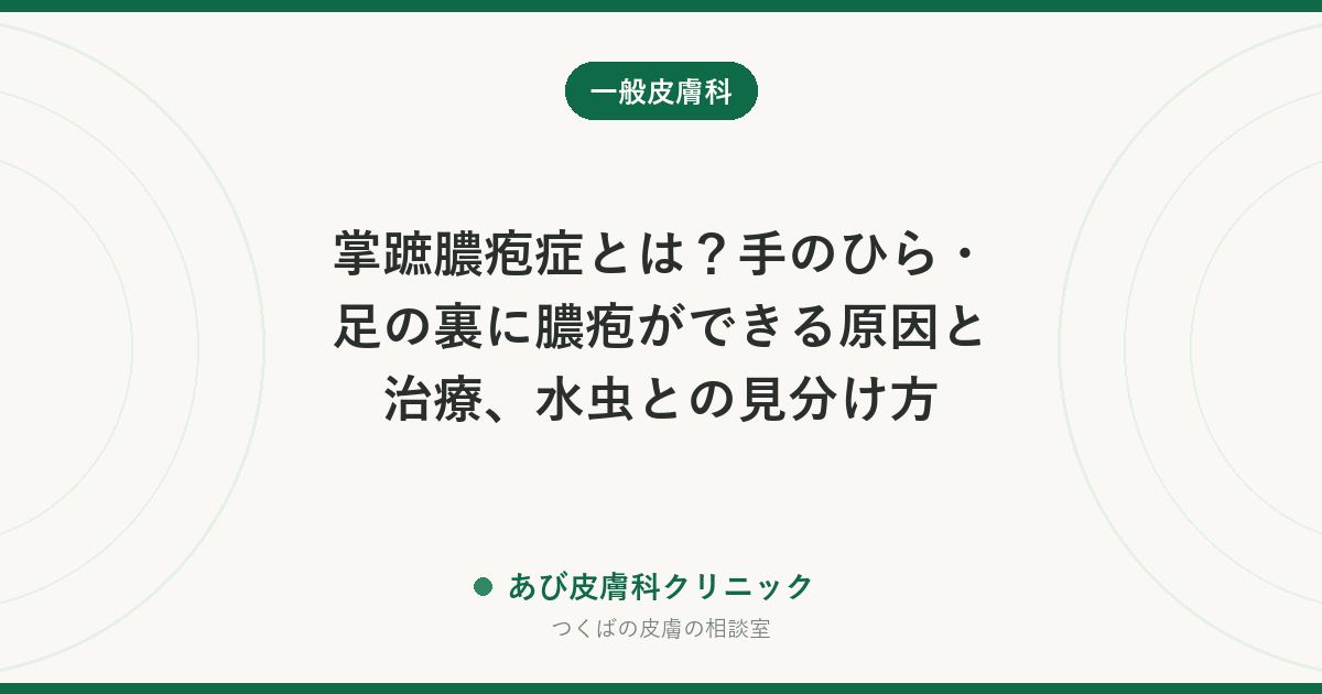 掌蹠膿疱症とは？手のひら・足の裏に膿疱ができる原因と治療、水虫との見分け方