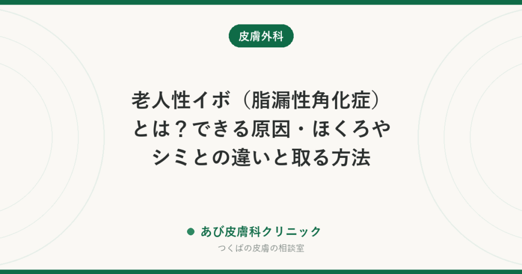 老人性イボ（脂漏性角化症）とは？できる原因・ほくろやシミとの違いと取る方法