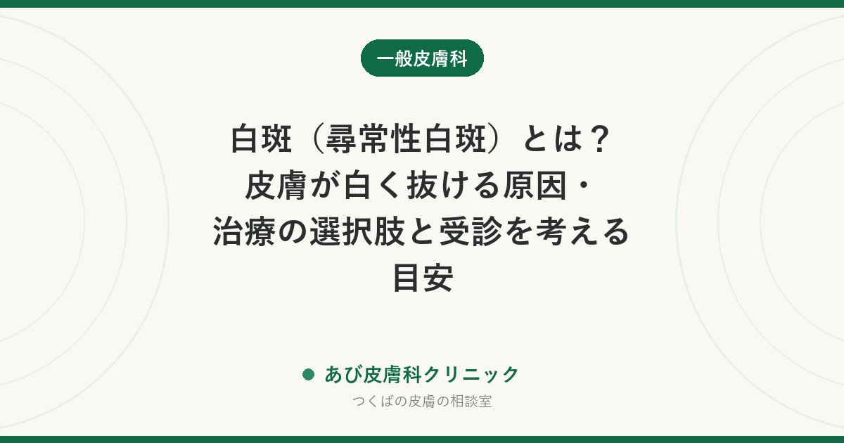 白斑（尋常性白斑）とは？皮膚が白く抜ける原因・治療の選択肢と受診を考える目安