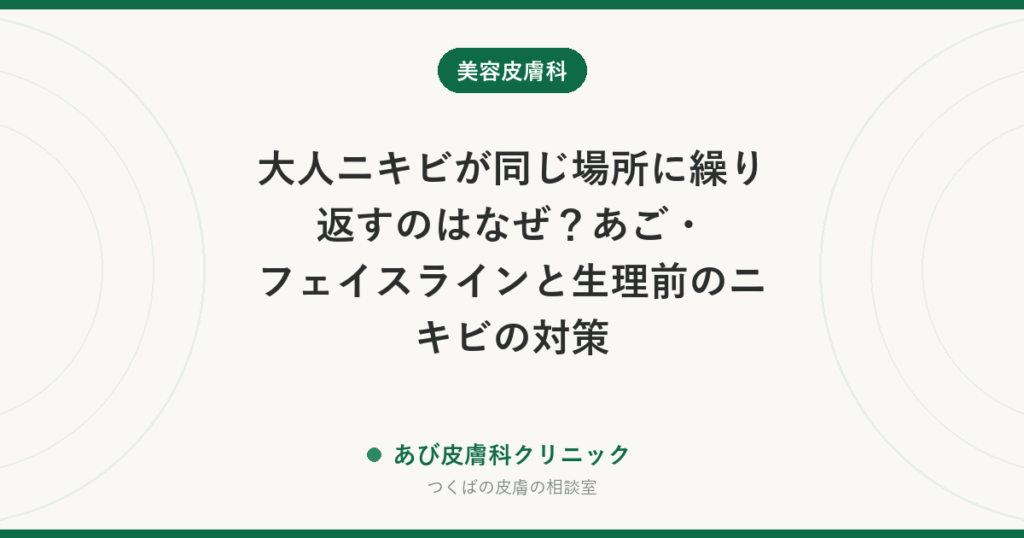 大人ニキビが同じ場所に繰り返すのはなぜ？あご・フェイスラインと生理前のニキビの対策