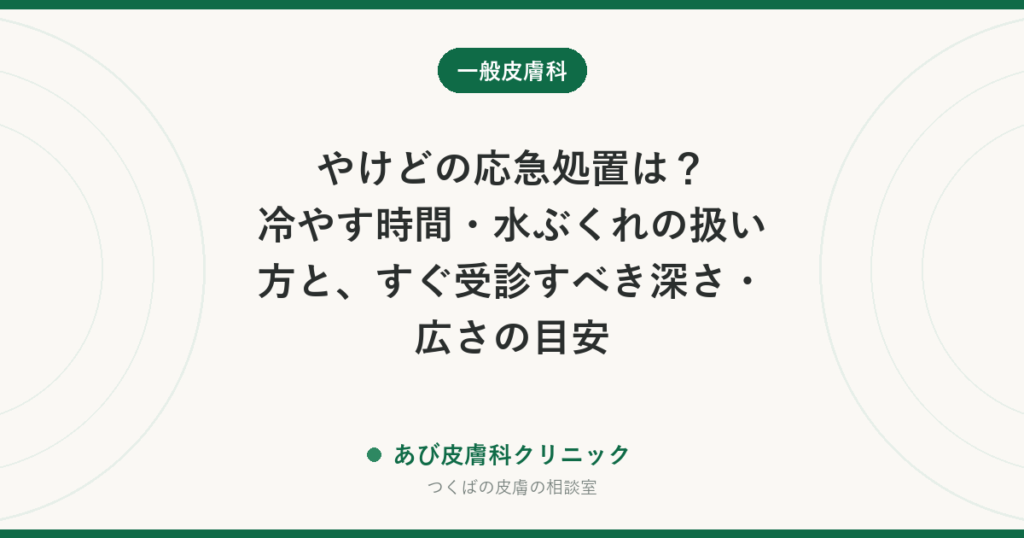 やけどの応急処置は？冷やす時間・水ぶくれの扱い方と、すぐ受診すべき深さ・広さの目安