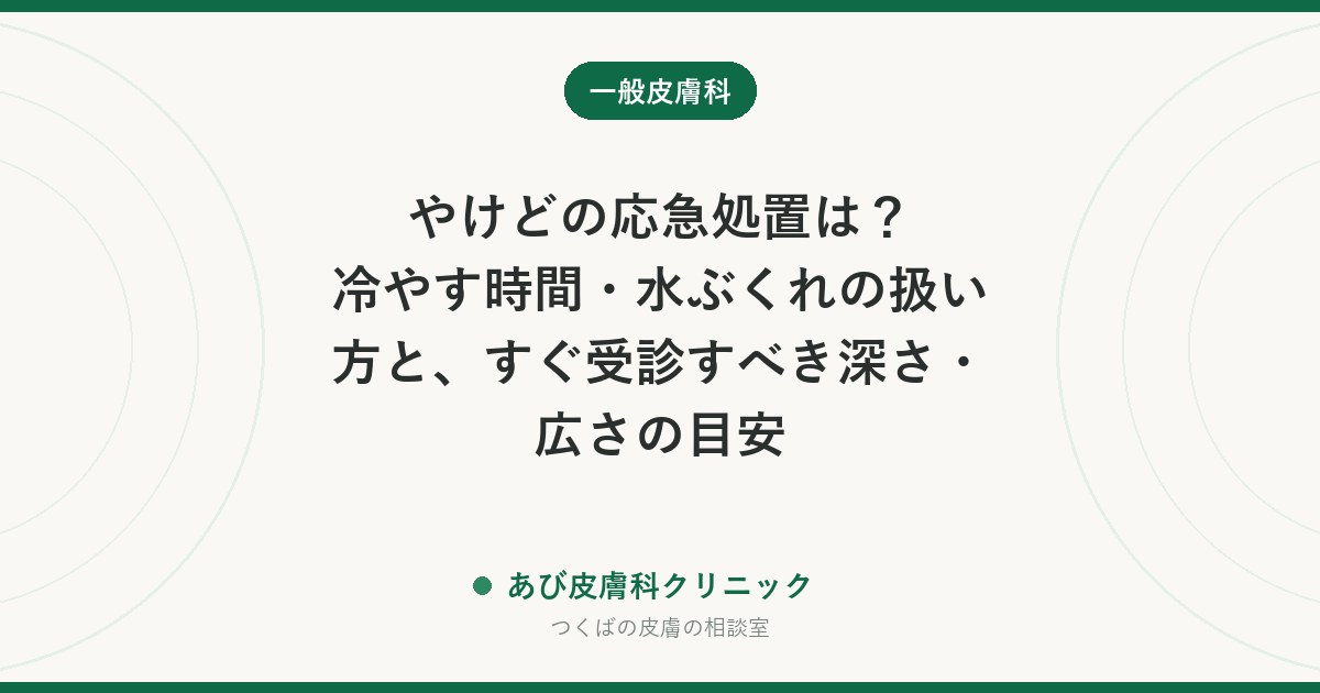やけどの応急処置は？冷やす時間・水ぶくれの扱い方と、すぐ受診すべき深さ・広さの目安