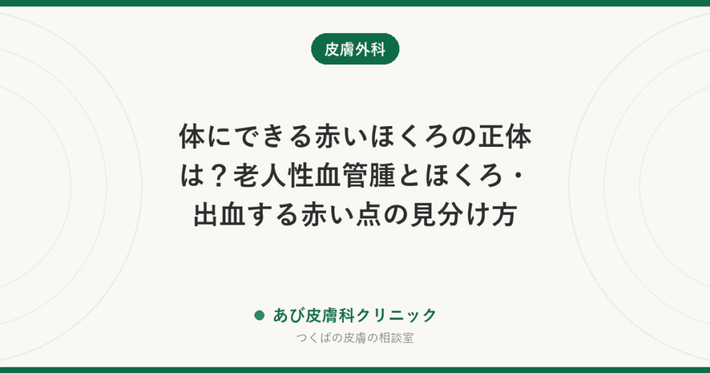 体にできる赤いほくろの正体は？老人性血管腫とほくろ・出血する赤い点の見分け方