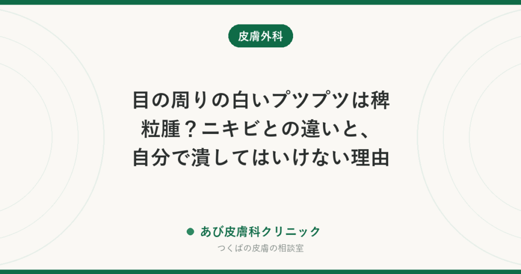 目の周りの白いプツプツは稗粒腫？ニキビとの違いと、自分で潰してはいけない理由