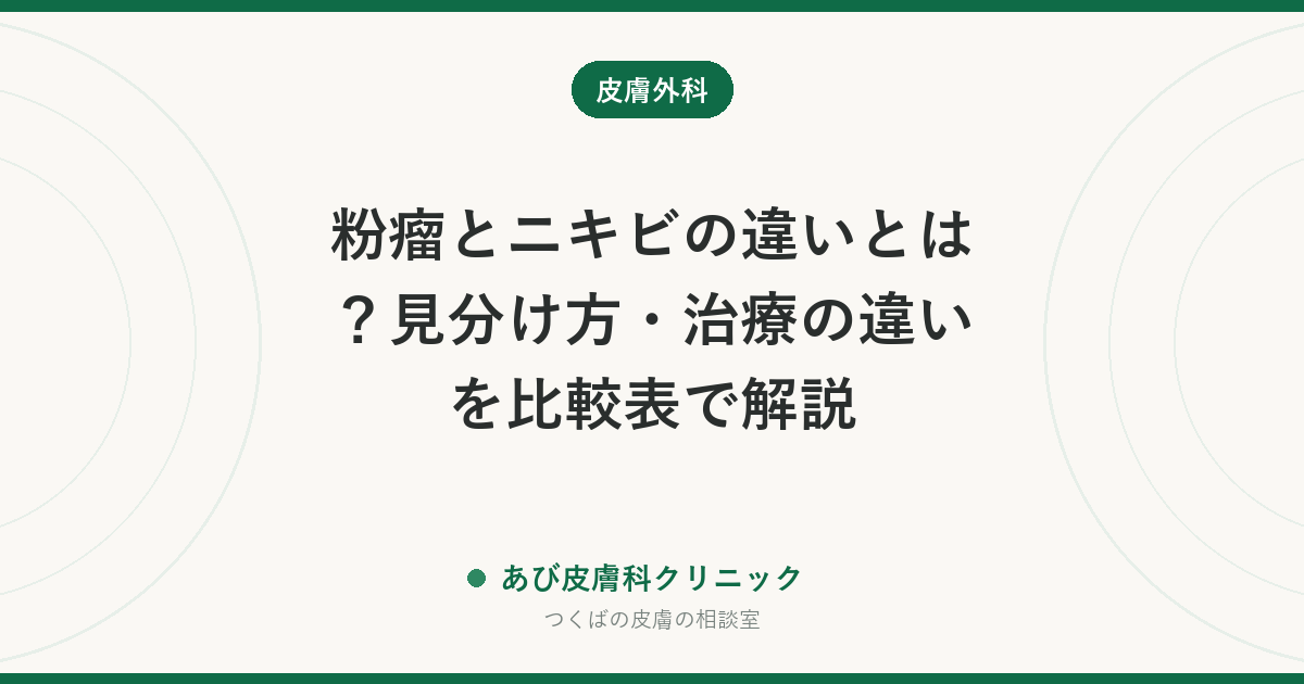 粉瘤とニキビの違いとは？見分け方・治療の違いを比較表で解説