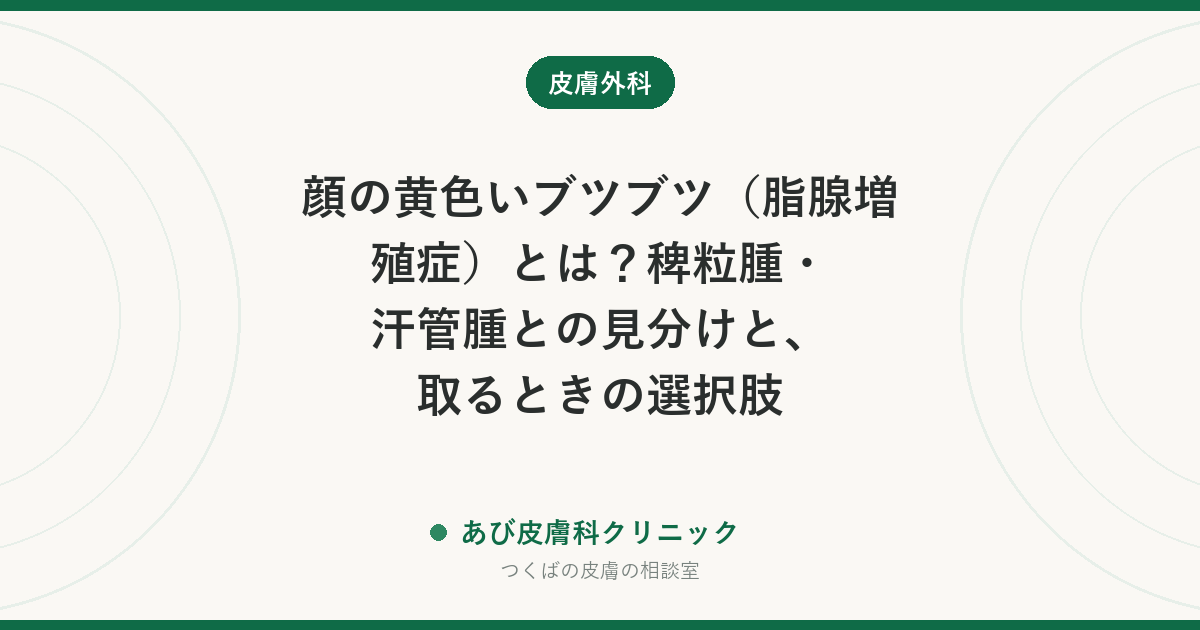 顔の黄色いブツブツ（脂腺増殖症）とは？稗粒腫・汗管腫との見分けと、取るときの選択肢