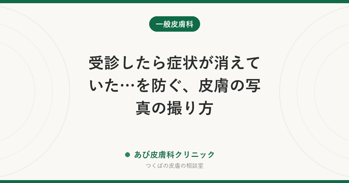 受診したら症状が消えていた…を防ぐ、皮膚の写真の撮り方｜じんましん・発疹・ほくろの変化を正しく伝える5つのコツ